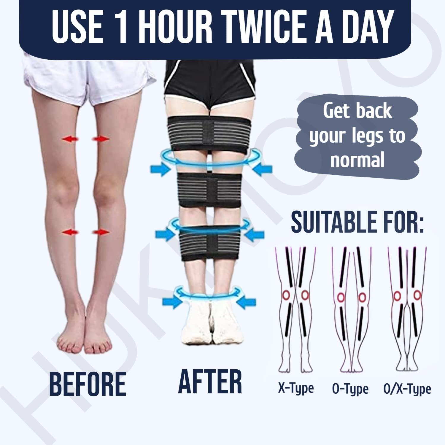 Hukimoyo Hukimoyo Bow Leg Correction Belt for Men Women o/x Type Bow Legs Posture Correction Belt Legs Straightener Bow Legs Support Day and Night Belt Leg Straight Support Bow Leg Belt (Black, Large)