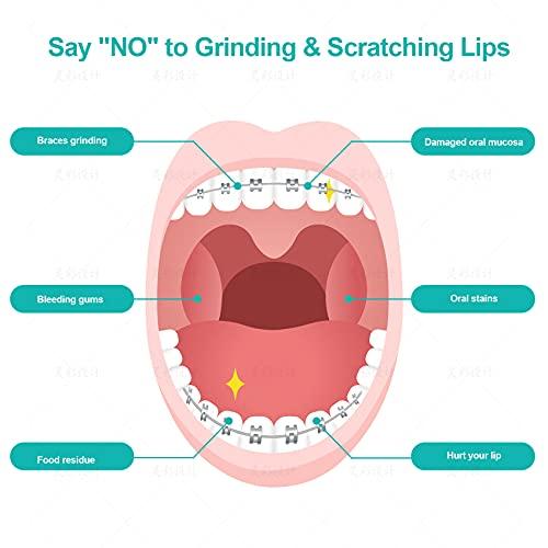 Annhua Annhua Orthodontist Wax Brace Wax Flavored 10 Pack, Dental Ortho Dots Wax Strips for Aligners, Braces Wearer, Brackets, Invisible-lingers, 10 Fruit Smell