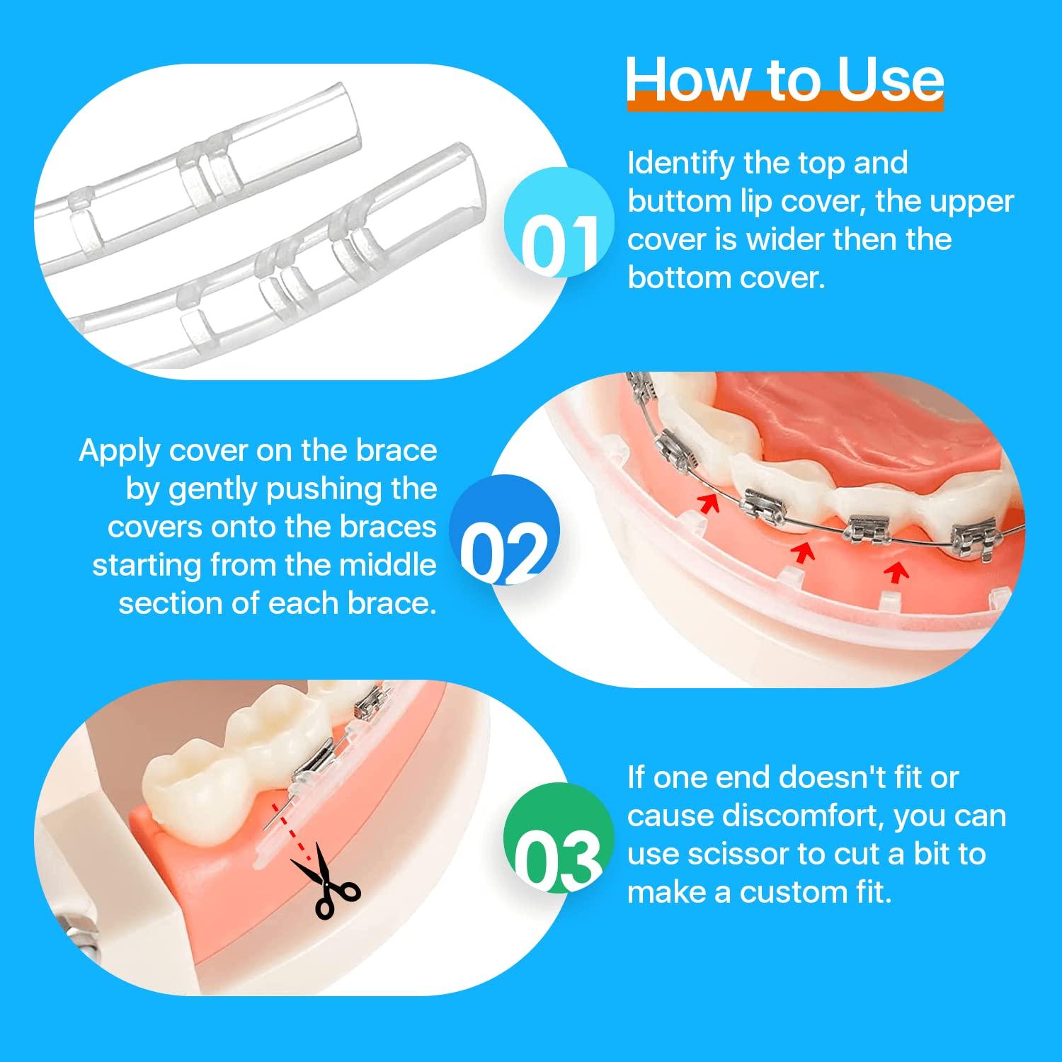AIM DENTAL SUPPLY AIM DENTAL SUPPLY Lip Protector for Braces Orthodontic & Dental Pain-Relief Comfort Lip Shield Mouth Guard Custom FIT Brace Covers by AIM DENTAL SUPPLY Dental Supply 2.0 Count