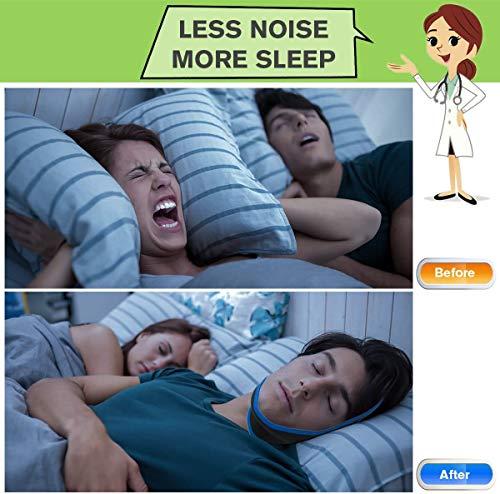 Atrilly Atrilly Anti Snoring Chin Strap Ajustable Stop Snoring Solution for Men and Women, Anti Snoring evices Snore Stopper Chin Straps Sleep S for Snoring Sleeping Mouth Breather