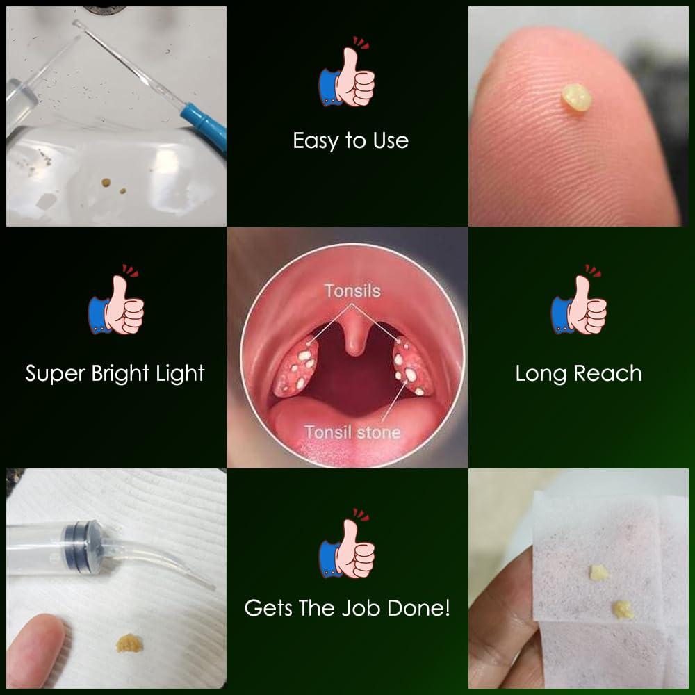 airgoesin Airgoesin Lighted Tonsil Stone Remover Tools or Earwax Removal Tools, Yellow, 3 Tips, Tonsillolith Pick Case + 1 Irrigator Cleaner : Yellow