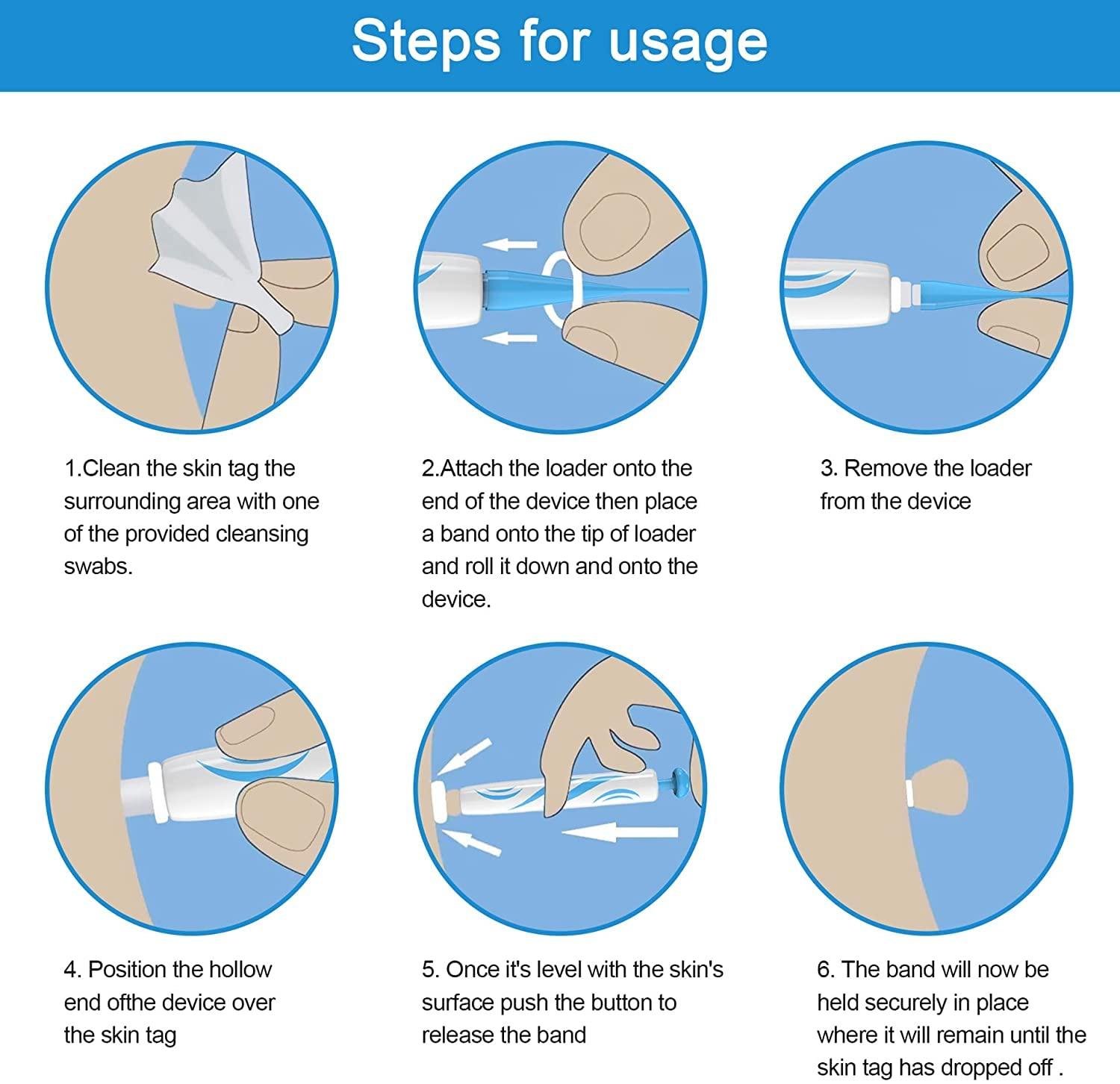 Wifamy Skin Tag Remover,Painless Skin Tag Remover Pen,Skin Tag Removal Kit Tools with 40 Micro and Regular Skin Tag Bands,Easy Skin Tag Remover Device to Remove(2mm-8mm) Skin Tags (2in1 Kit)