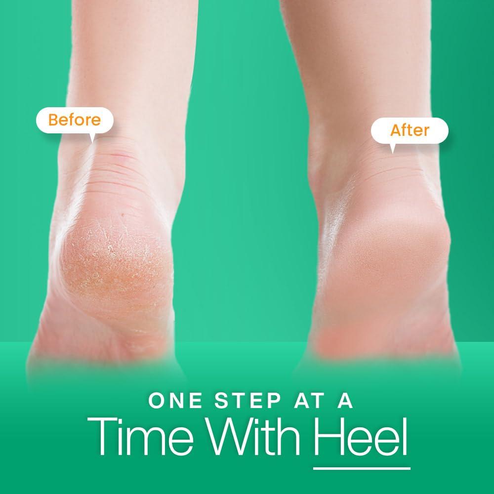 Stepify Stepify Silicone Gel Heel Socks - (Pack of 3 combo) Washable and Reusable Silicon Socks for Men & Women, Heel Pad For Heel Pain, Fore foot pad, Toe Free Heel Pad. (Pink)