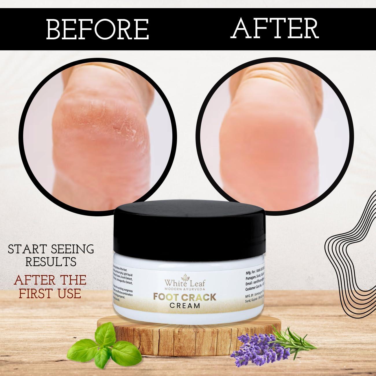 White Leaf White Leaf Foot Cream for Cracked Heels & Dry Feet, Foot Care Cream With Organic & Olive Oil, Moisturizing Healthy Feet for Men & Women - 50 gm