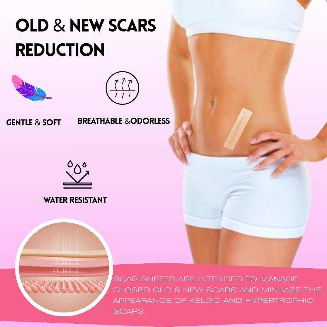 SCARXGEN Scarxgen Silicone Gel Sheet | Scar Sheet | Scars, Cuts and Scrapes, Laparoscopic scar | Reusable and Washable Sheet | Keloid and Hypertrophic scar I Visible scar reduction (3CMX20CM(BOX OF 1 UNIT))