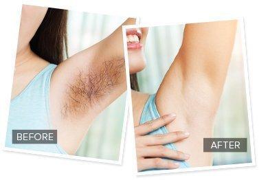 Param Param Electric Hair Remover Finishing Touch Pain-Free Plastic Shaver, Multicolour