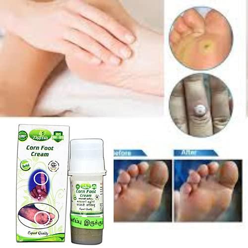 CTM EXPORTS CTM EXPORTS Zigma Ointment For Kaal Aani Cream (500Mg) - (Pack Of 500Mg X 2) - Foot Corn Remover, Hand Corn Remover, Callus Remover, Kapasi Remover Cream/Malam (Pack Of 2)