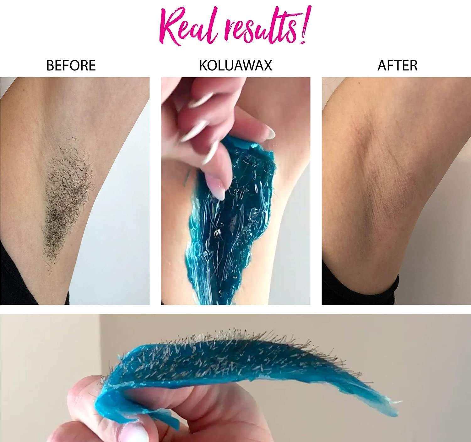 EQUVIA EQUVIA Waxing Kit Wax Warmer Hair Removal with Hard Wax Beans 100 gm. Multiple Formulas Target Different Type of Hair, Eyebrow, Facial, Armpit, Bikini, Brazilian, for Women and Men.