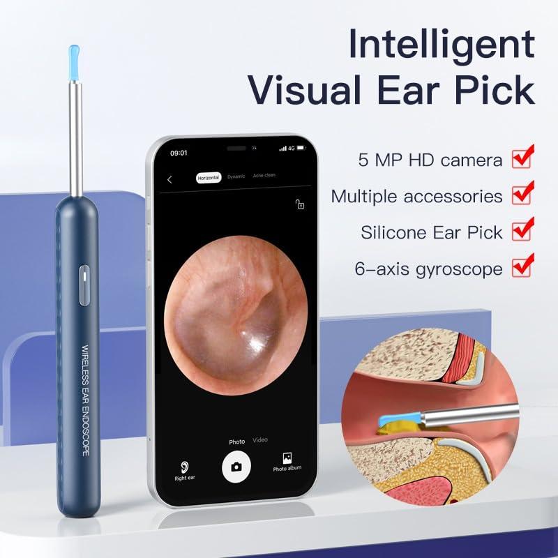 AJUK AJUK Wireless Ear Cleaning Tool Kit 1080P HD Display Earwax Removal, Otoscope for Adults, Children, and Pets, Ideal for Ear, Nose, Throat, Teeth, and Scalp Inspection