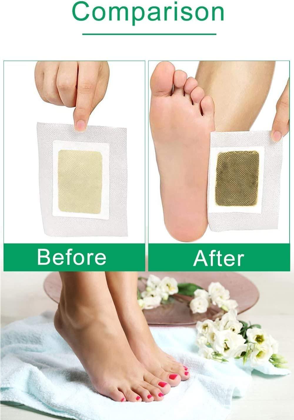 Prishva Prishva Premium Detox Organic Health Foot Patch Remove,Pain Free Foot Pads for Stress Relief Sleep, Natural ingredients Toxins Ginger Foot Detox Pads For Adhesive Foot And Body Cleansing (Pack of 50)