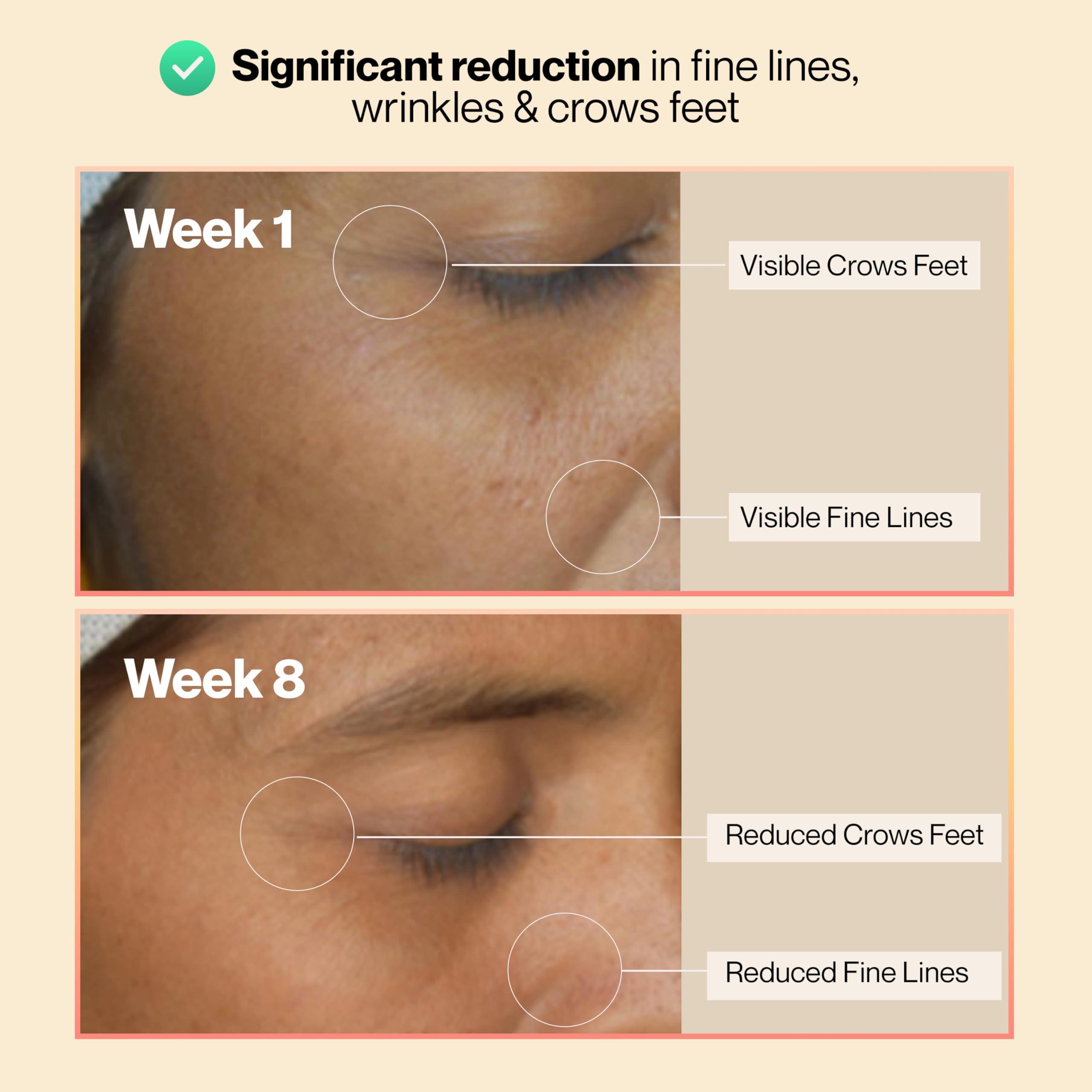 SETU Setu Skin: Youthful Marine Collagen Powder (15 Sachets) | Collagen Supplements for Women & Men | Hydrolyzed Type 1 & 3 Collagen for Healthy Skin, Hair & Nails | Peach Mango Flavor