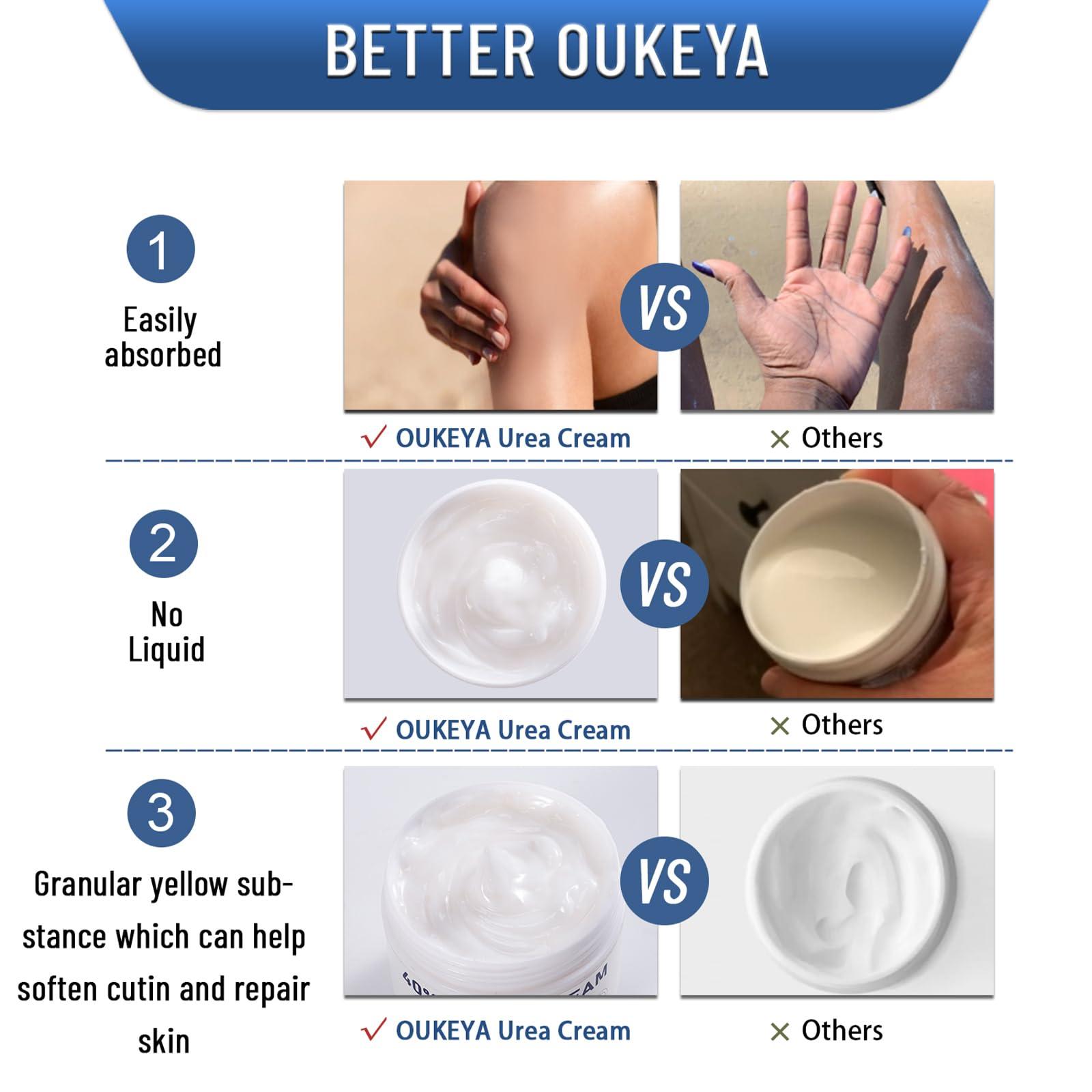 OUKEYA OUKEYA Urea Cream 40 Percent, Urea Foot Cream for Dry Cracked, 40 per Urea Lotion for Feet Maximum Strength