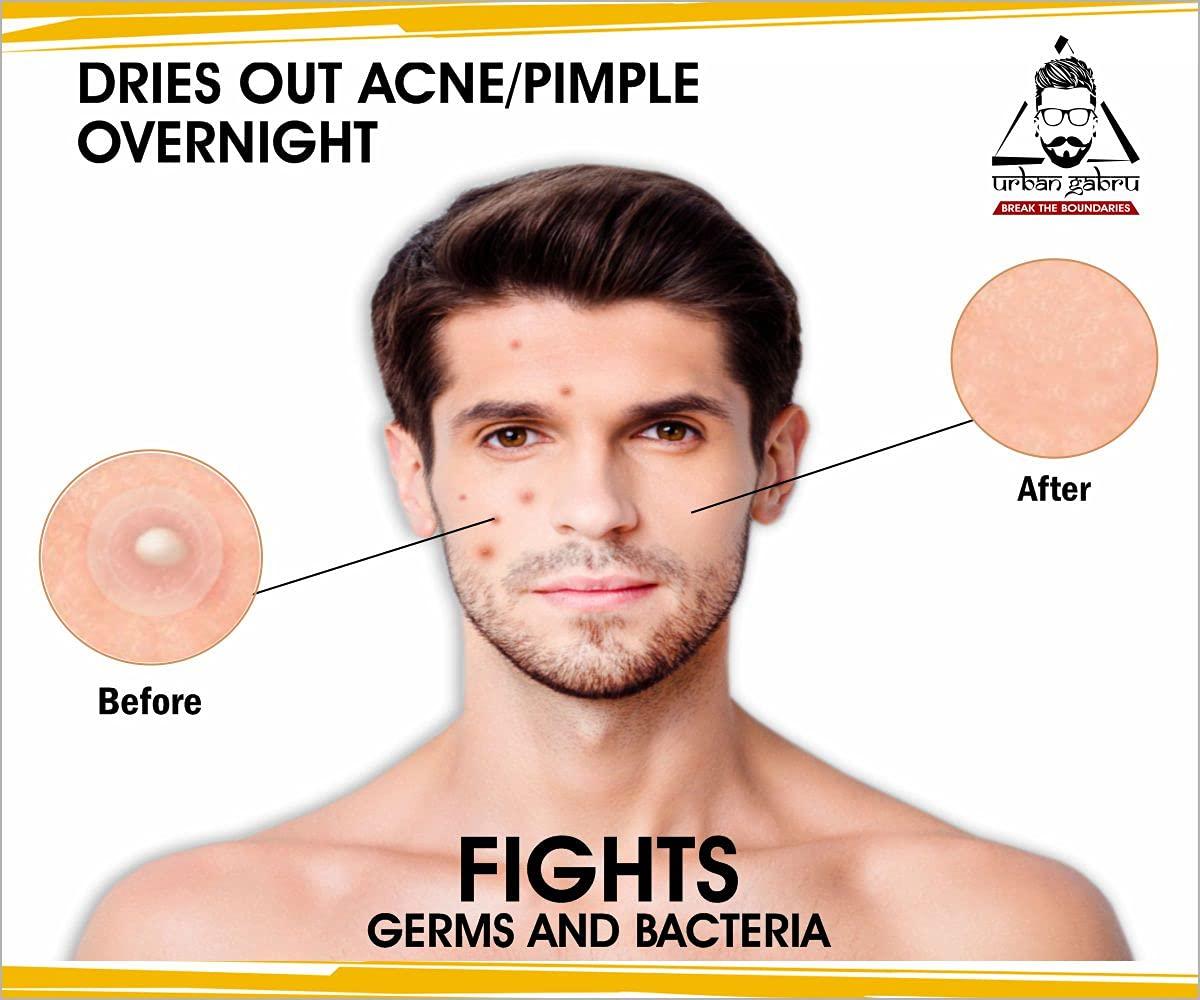 urbangabru urbangabru Men Hair Removal Cream Spray (200 Ml) + Acne Pimple Patch (72 Dots) - Body And Face Care Combo Kit, Pack of 1