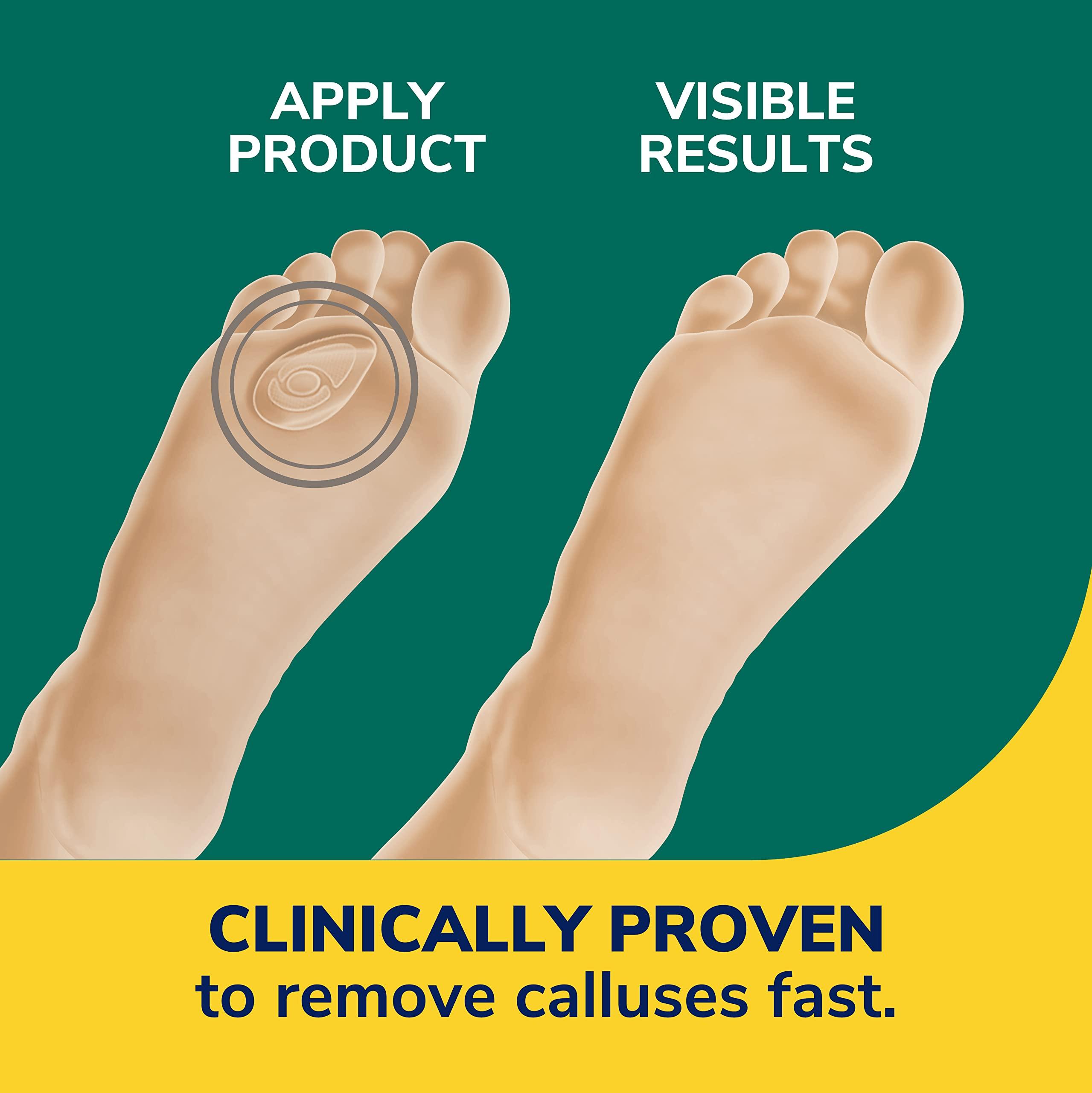 Dr. Scholl's Dr. Scholl\'s Callus Remover with Advanced Duragel Technology, 4-Pack