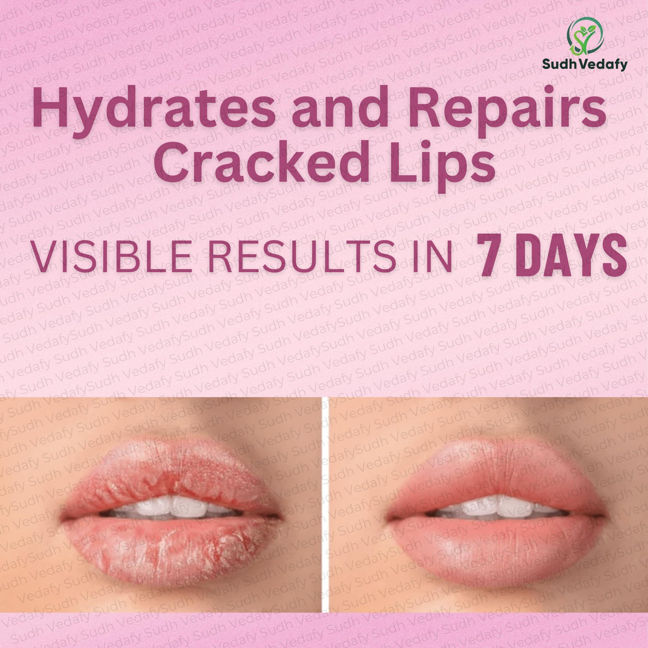 Sudh Vedafy Sudh Vedafy Sri Ram Nabhi Tailam 30ml | Ayurvedic Multi Benefit Nabhi Oil | Belly Button oil for Skin & Hair | Nabhi Oil ayurvedic for Health and Beauty | (Pack of 1)