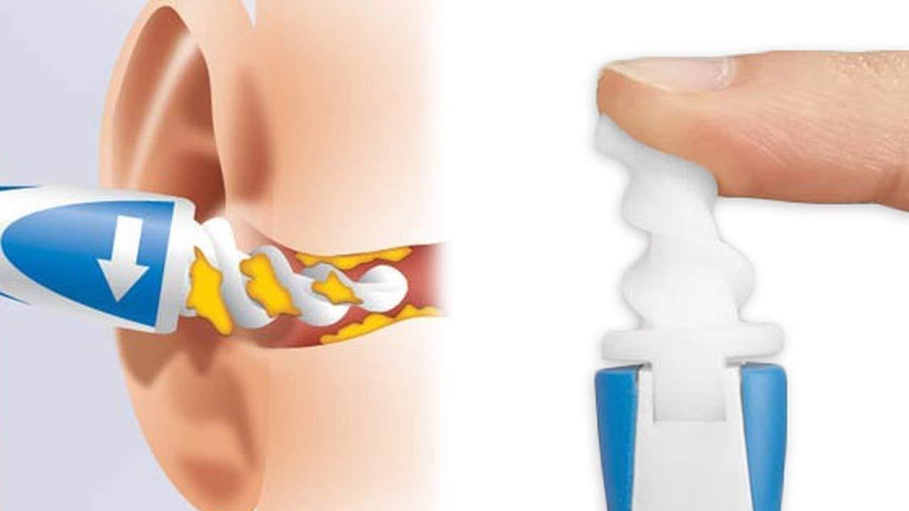 Glenoxzone GLENOXZONE Electric Plastic Ear Wax Vac Remover Kit And Ear Cleaner Smart Swab Easy Earwax Removal with 16 Disposable Soft Tips Ear Wax Cleaner (Smart swab)