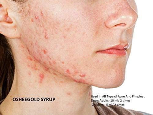 OSHEEKA PHARMACEUTICALS OSHEEKA Osheekagold Antioxydant Multivitamins Multiminerals Tablets For Nutritional Management (Pack of 6)