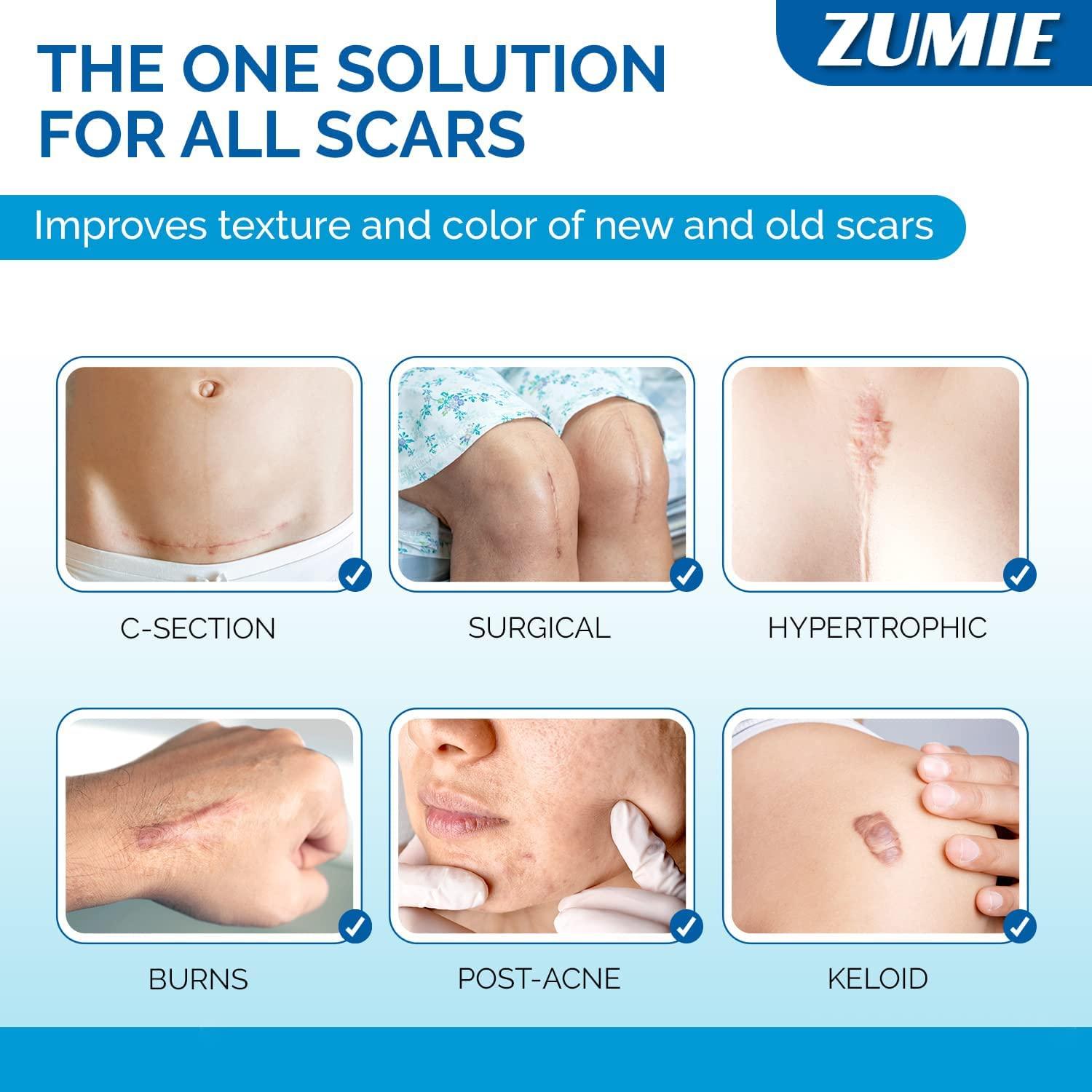 ZUMIE ZUMIE Silicone Scar Removal Sheets Post Surgery & Acne Scars Treatment-2 Month Supply Cica Care Gel Sheets Wound Repair Scar Silicon Soft Long Strips & Sheets (2pcs Scar repair tape)