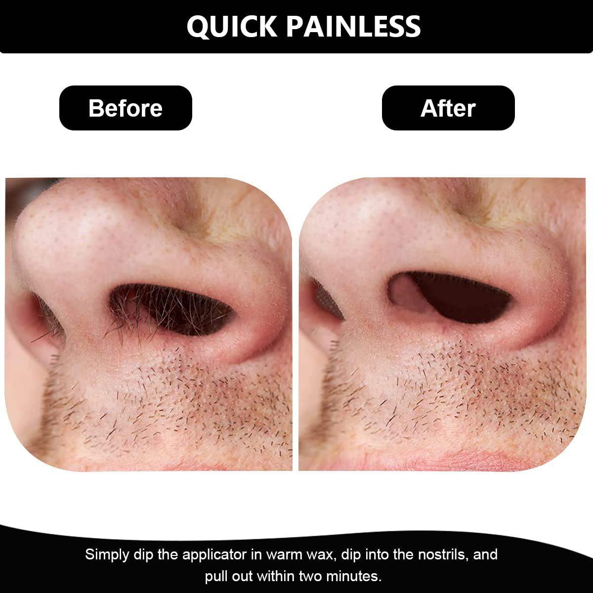 HANNEA HANNEA Nose Wax Kit, Men & Women\'s Nose Hair Waxing Kit with 100g Wax Beads for Quick & Easy Removal