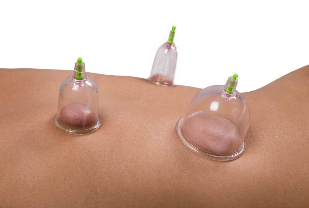 Sampton Sampton Hijama Cupping Set With Pump Vaccum Cupping Set For Pain Relief And Reduce Blood Fat Chinese Cupping Set 6 Cup Vaccum Apparatus