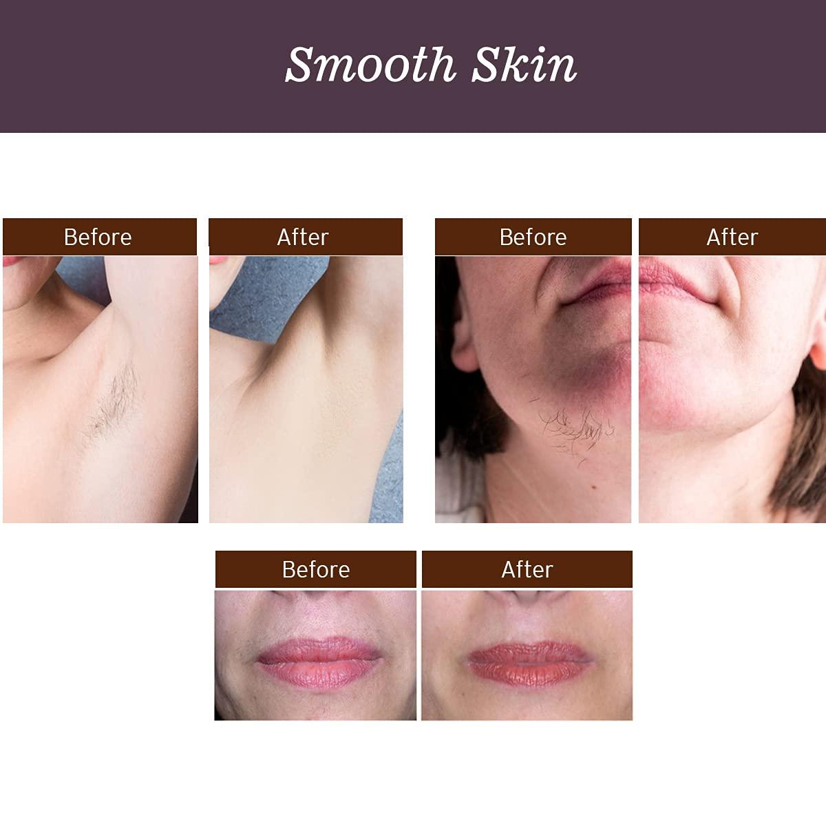 Crystal Care PROFESSIONAL Brazilian Wax | Premium Stripless Peel-Off Hair Removal Wax | Ideal for Bikini, Face, Eyebrows, Underarms, and Sensitive Areas | 300g Pack | Gentle and Effective | No Strips Needed | Achieve Smooth, Hair-Free Skin at Home