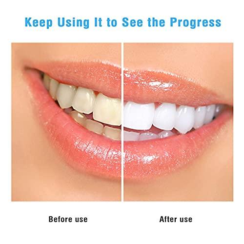 ubersweet Ubersweet® Imported Baugger 50pcs TEE-TH Wipes Oral Brush Ups Deep Cleansing Finger Tooth Wipes Fresh Breath Mint Flavor TEE-TH Whitening Strips Oral Care_182685