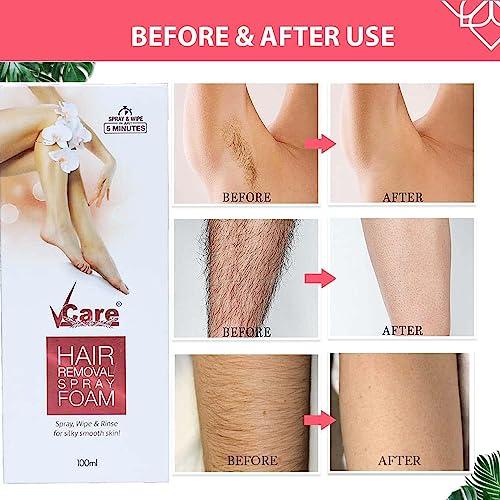 VCare VCare Hair Removal Spray Foam & Hair Growth Retardant Gel Combo -Effective & Painless Body Hair Removal Cream|Reduce Unwanted Hair Growth on Body, Safe &Non-Irritating Hair Remove Cream for Legs& Arms