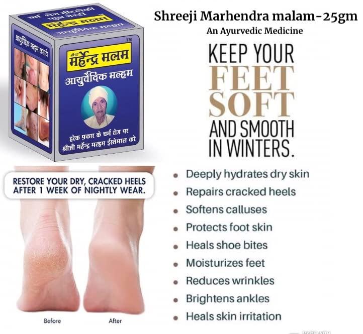 RUDRAMANI RUDRAMANI Shreeji Marhendra Anti fungal Malam - for Ringworm, itching, Eczema,Burn Mark, Foot Care (50G)