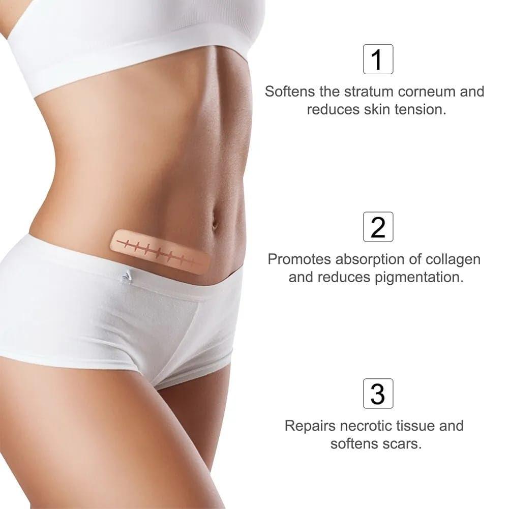 Dr. Navadiya Soft, Washable Silicone Scar Sheets - Painless Scar Removal for Surgery, C-section, Burn Etc. - Suitable for All - 1 Roll (150 Cms)