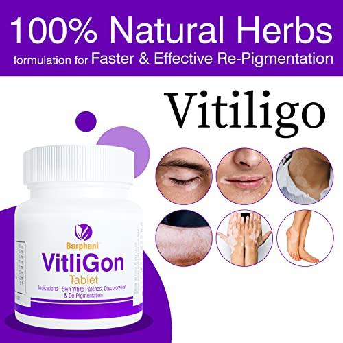 BARPHANI Barphani VitliGon Tablets - Super Effective on Vitiligo White Patches, Discolouration, De-Pigmentation, Faster Results, Helps Restricts Spread- 60 Tab Pack