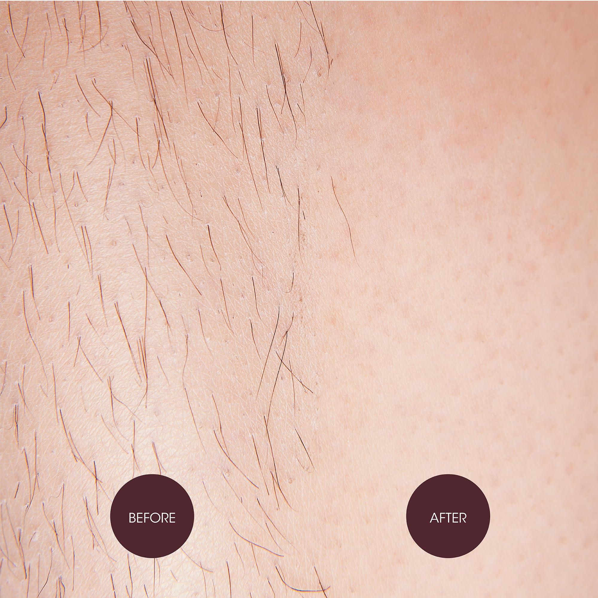 NAD'S Nad's Brazilan & Bikini Wax Kit, 4.9-Ounces