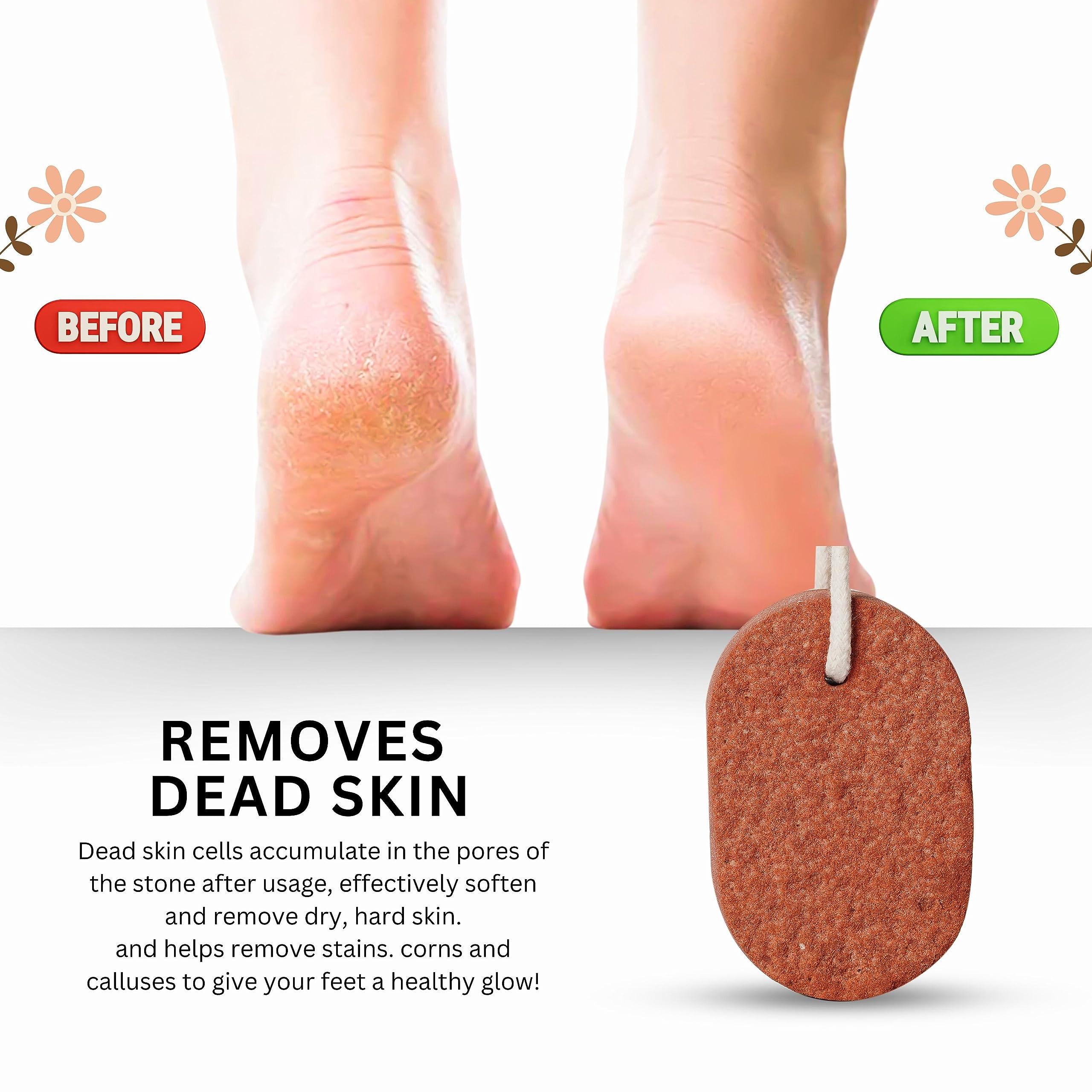 Jupiter Zone Original Rock Stone for Feet Care I Callus Remover, Foot Scrubber | Exfoliates Dry and Dead Skin, Softens Feet & Ankles (1 Pack) (M3)