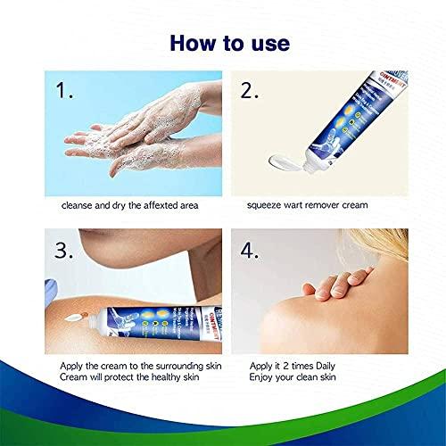 Generic Warts Remover Cream Extract Skin Face Tag Extract Corn Treatment Ointment Painless For Men Women Childrens (Pack of 4 of 100G)